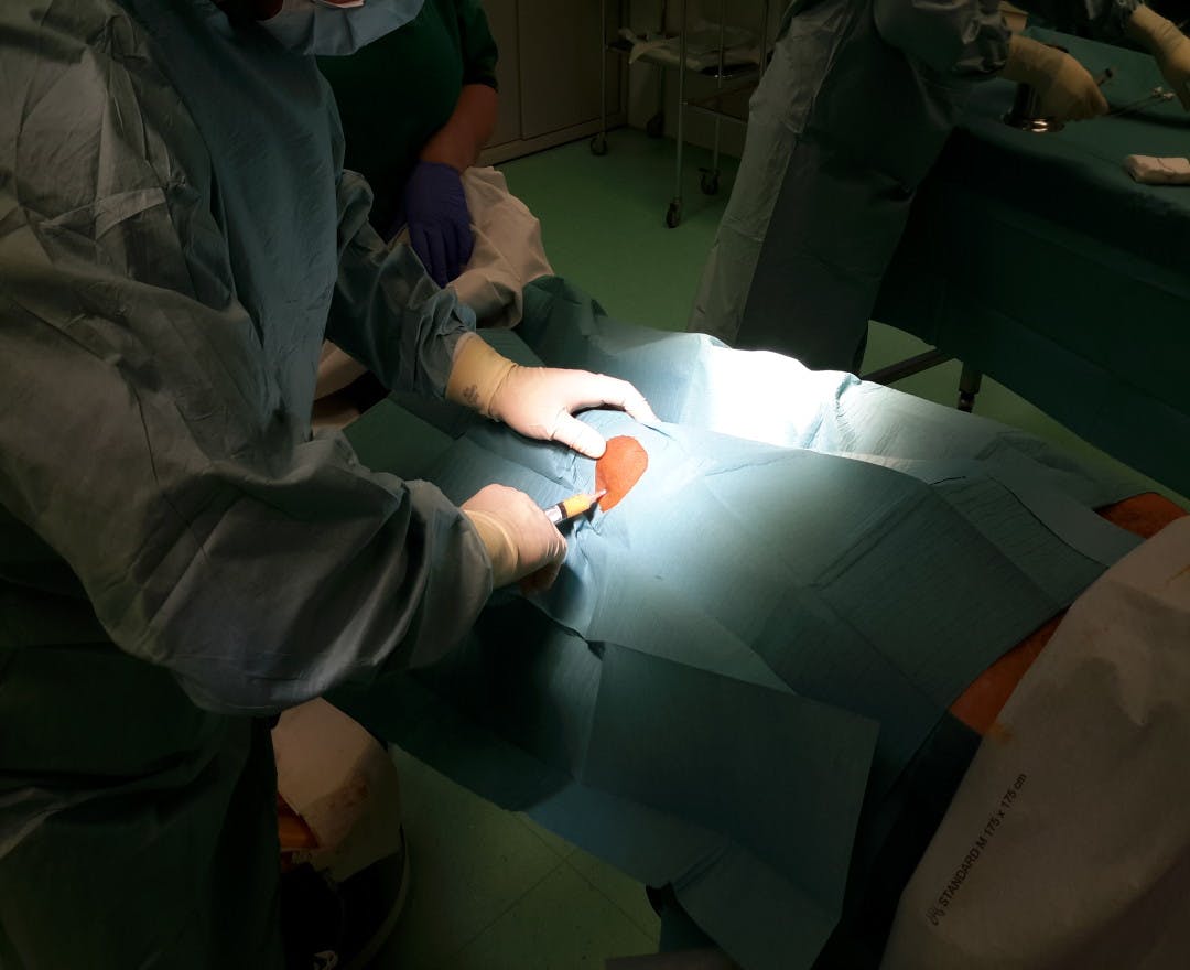 Image8_Ask The Expert: Lipogems As An Alternative To Orthopedic Surgery