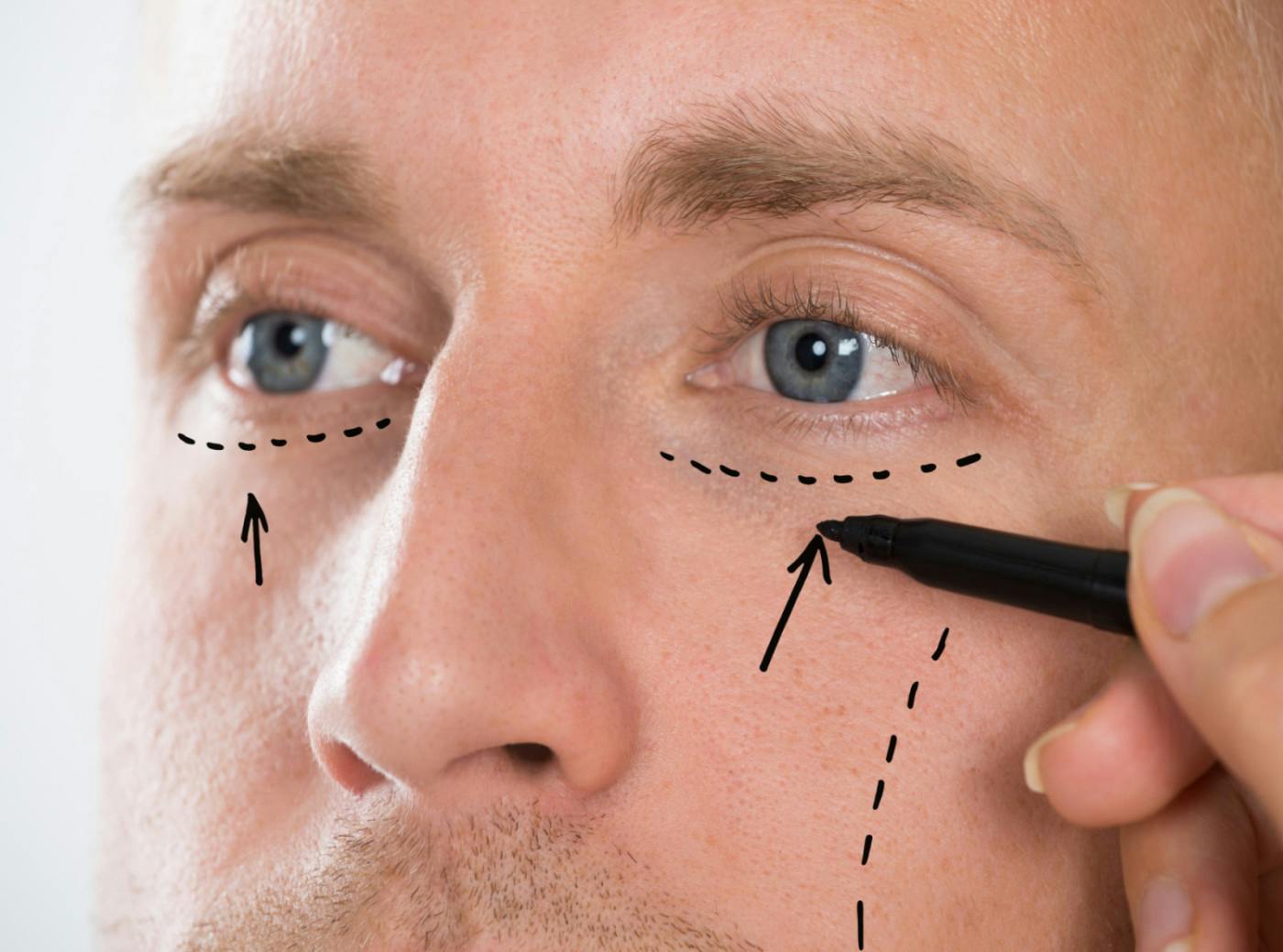 Image5_Plastic Surgery For Men: Trends And Procedures