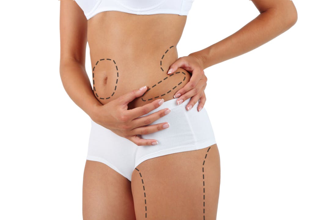  Liposuction Cost Guide, Abdominoplasty Cost Guide
