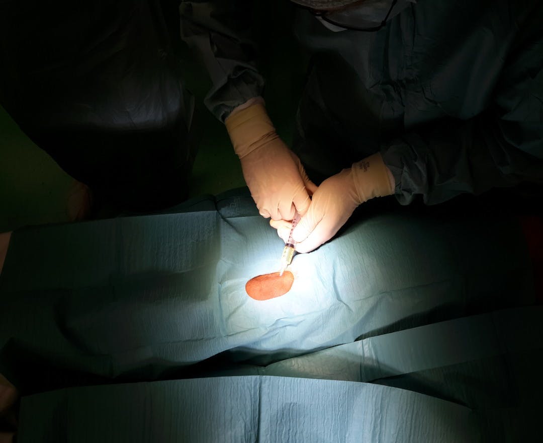Image7_Ask The Expert: Lipogems As An Alternative To Orthopedic Surgery