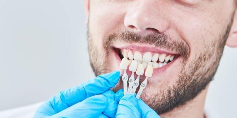 A dentist examines a patient's teeth so that custom veneers can be made.