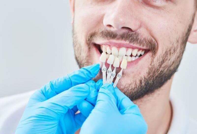 Ein Zahnarzt untersucht die Zähne eines Patienten, damit individuelle Veneers angefertigt werden können.