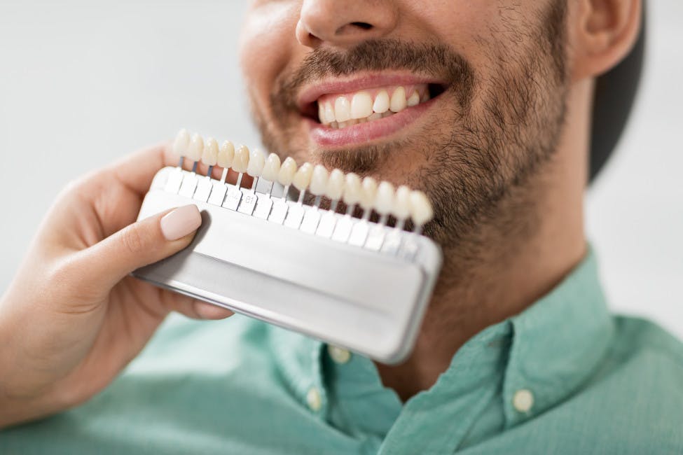 Hombre sonriendo y preparándose para ponerse las carillas dentales.