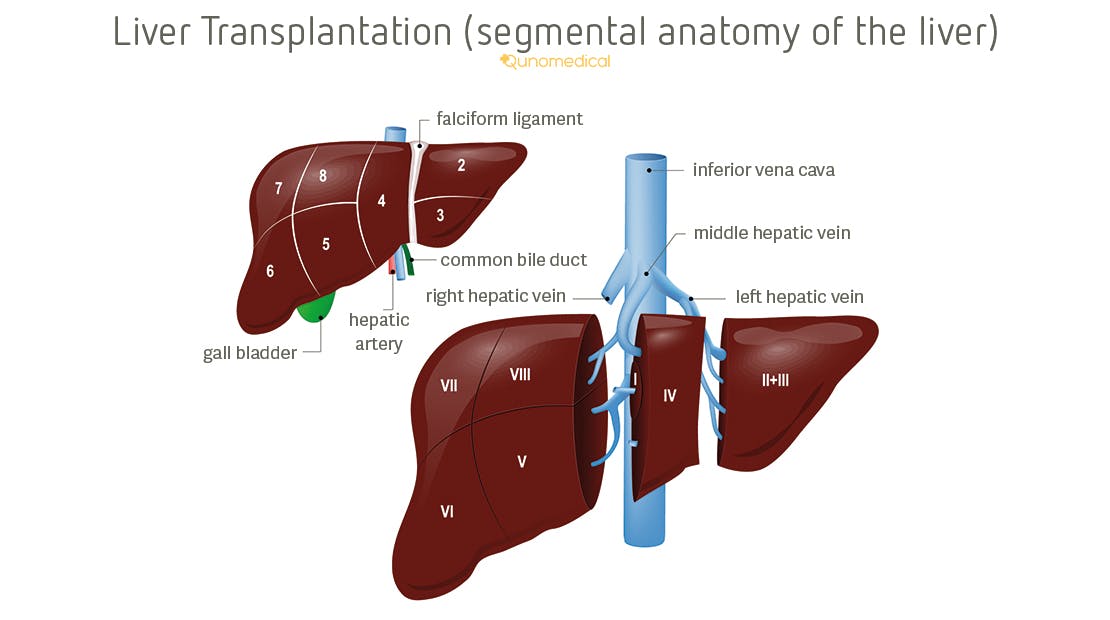 Illustration showing the segmental anatomy of the liver and how portions are divided for transplant purposes.  