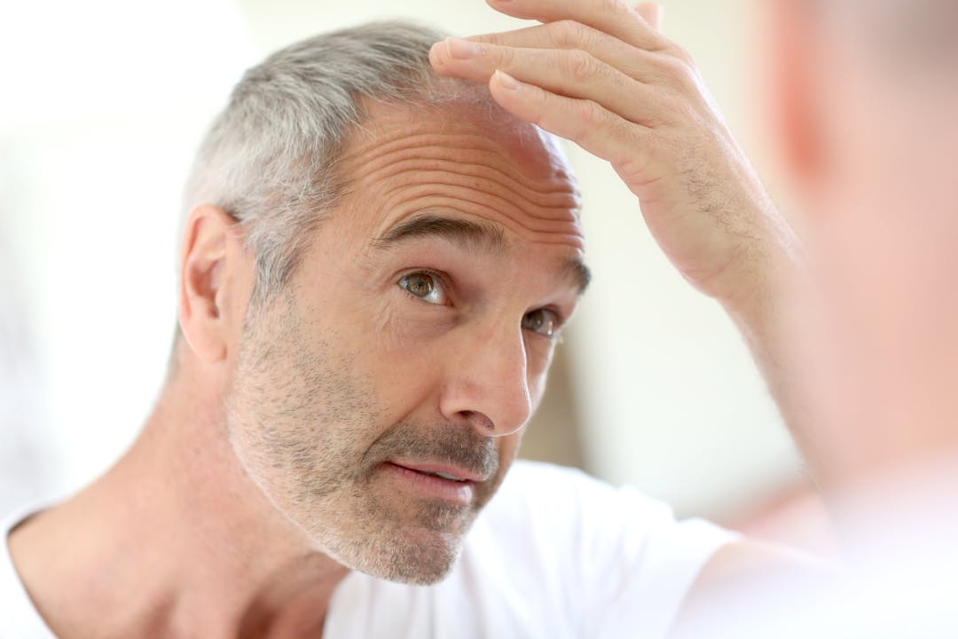 Older balding man looking in the mirror at his hairline 